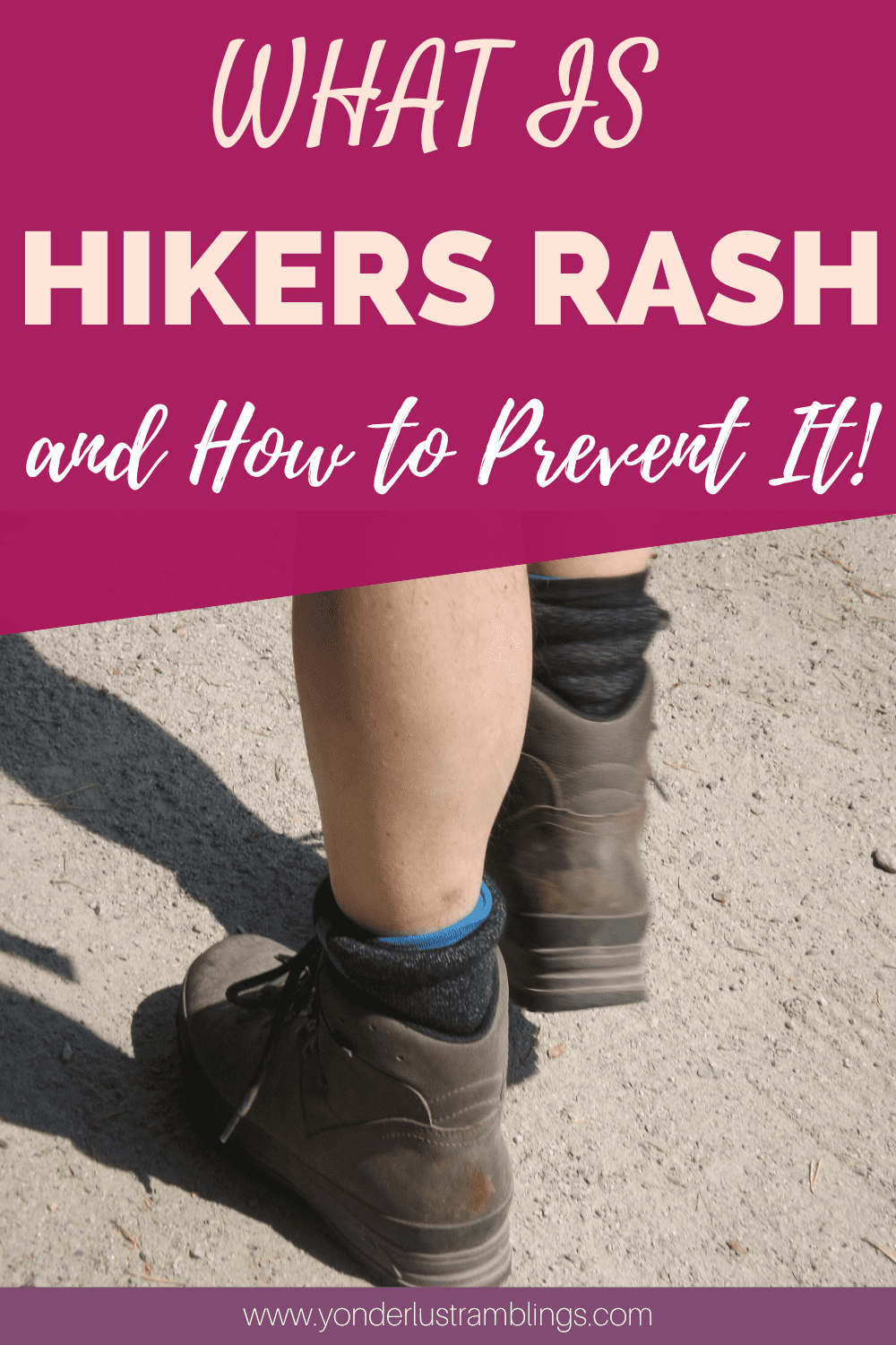 Hikers Rash What Is It, and How to Prevent It